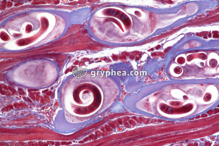 Trichinella spiralis x25 - gryphea.com